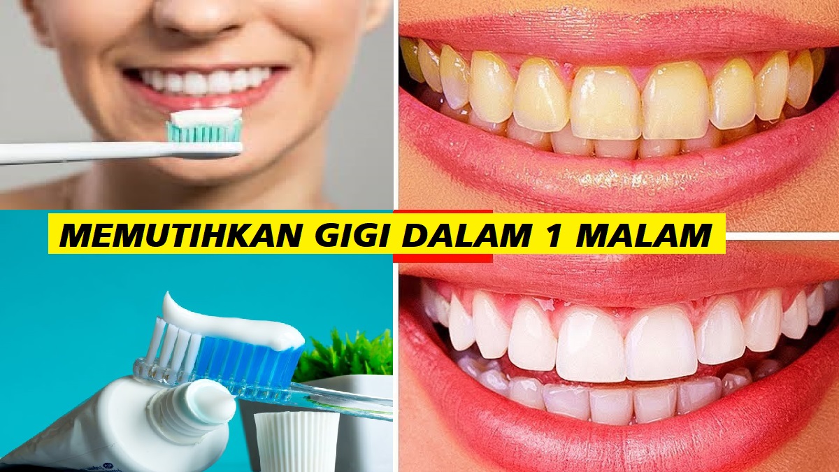 5 Merek Pasta Gigi yang Ampuh Memutihkan Gigi Secara Instan dalam 1 Malam, Gigi Bersih Bebas Plak Membandel