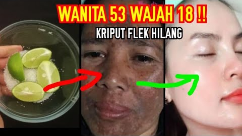 Cara Gampang Menghilangkan Flek Hitam dengan Jeruk Nipis, Bikin Wajah Kencang Awet Muda di Usia 50 Tahun