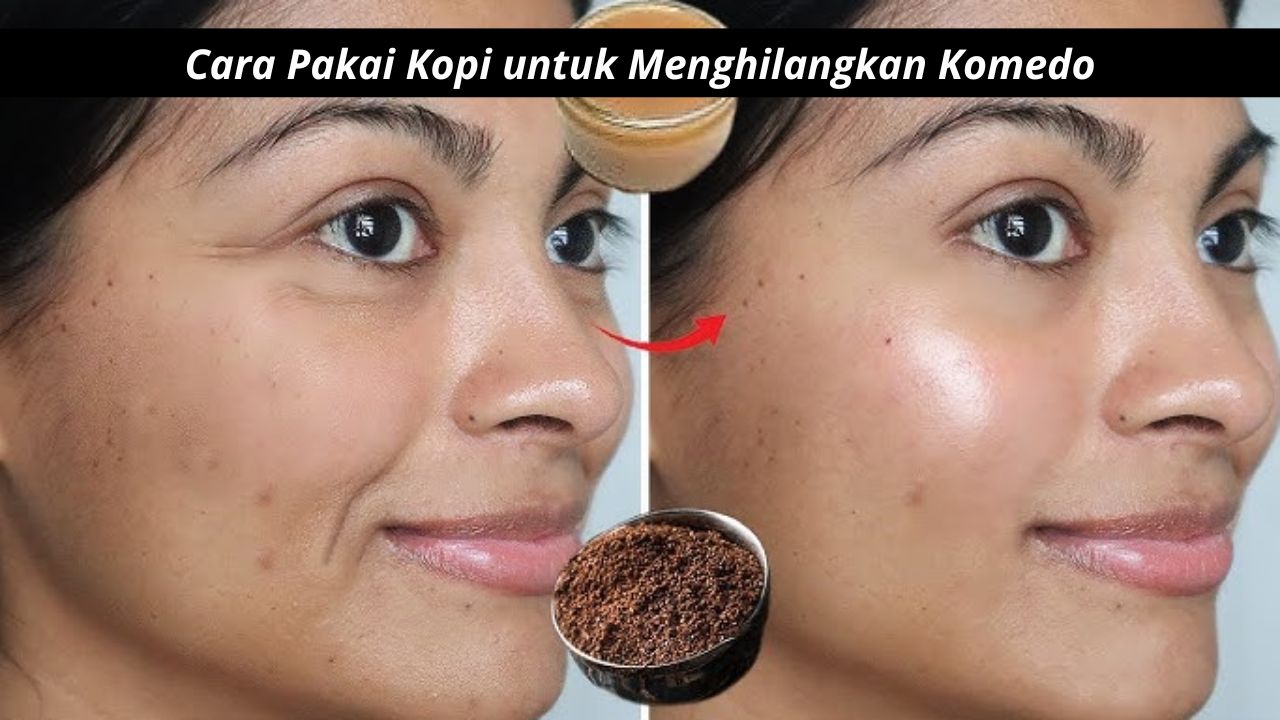 Gampang, Begini Cara Pakai Kopi untuk Menghilangkan Komedo dengan Tambahan 1 Bahan Alami