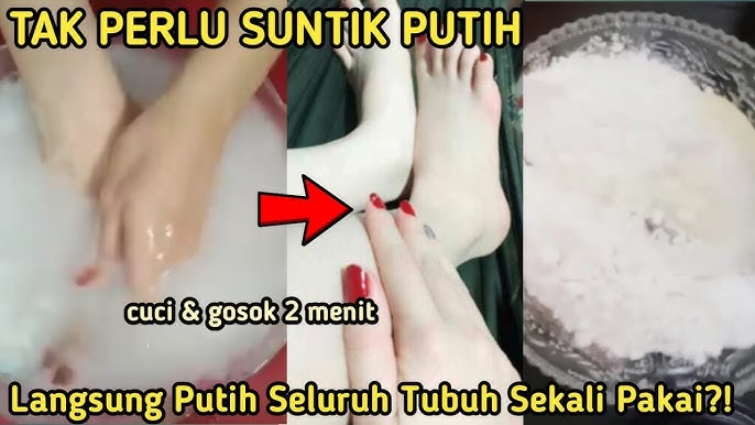 4 Cara Hilangkan Bekas Koreng Secara Alami yang Ampuh, Kulit Kembali Mulus dalam 1 Malam