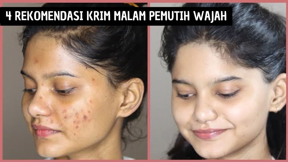 4 Rekomendasi Krim Malam Pemutih Wajah, Bikin Wajah Glowing Bantu Pudarkan Flek Hitam