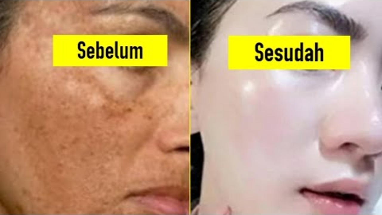 3 Cara Terbaik untuk Menghilangkan Flek Hitam di Usia 50 Tahun, Ibu-Ibu Wajib Coba!