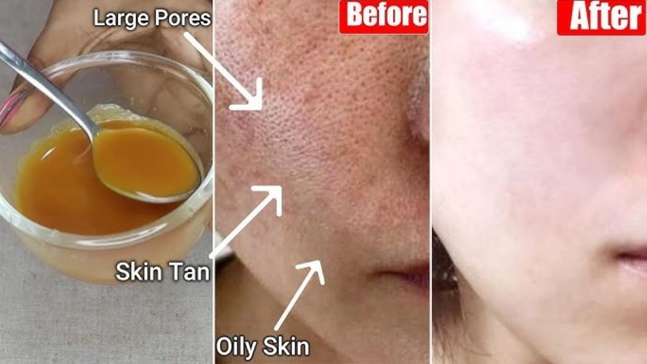 DIY Racikan Bahan Dapur Pemutih Wajah, Flek Hitam Pudar dalam 4 Langkah