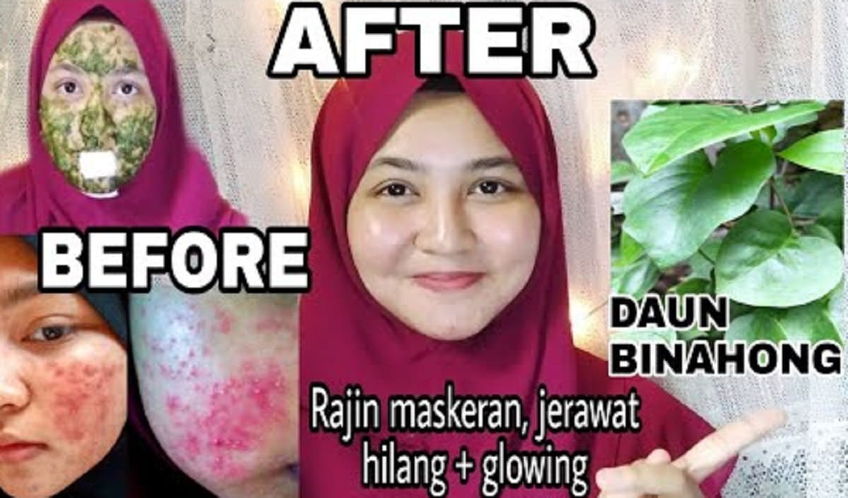 Bagaimana Cara Pakai Daun Binahong untuk Wajah Putih Glowing? Yuk Simak caranya Berikut Ini