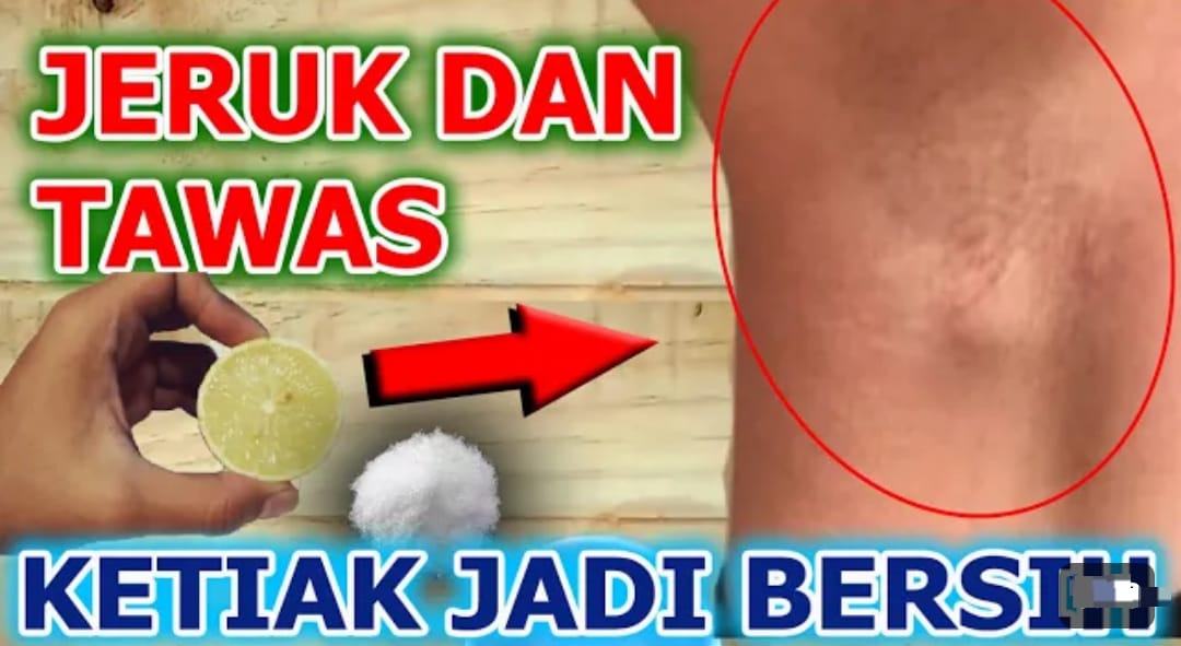 2 Cara Memutihkan Ketiak Dengan Lemon Dalam Sekali Usap, Ampuh Hilangkan Bau Ketiak dan Keringat Berlebih