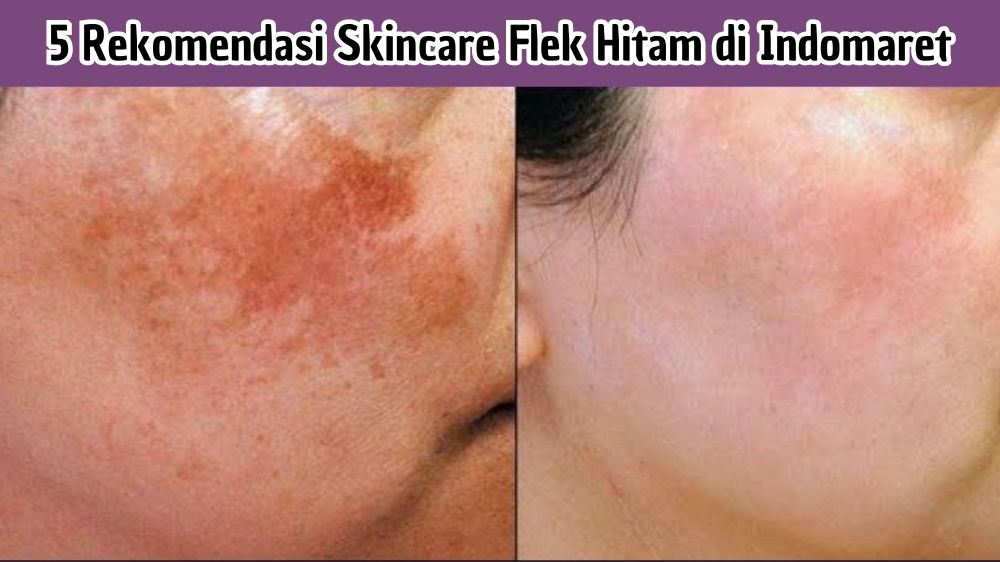 5 Rekomendasi Skincare Flek Hitam di Indomaret, Bikin Wajah Glowing dengan Cepat Cocok untuk Usia 40 Tahunan