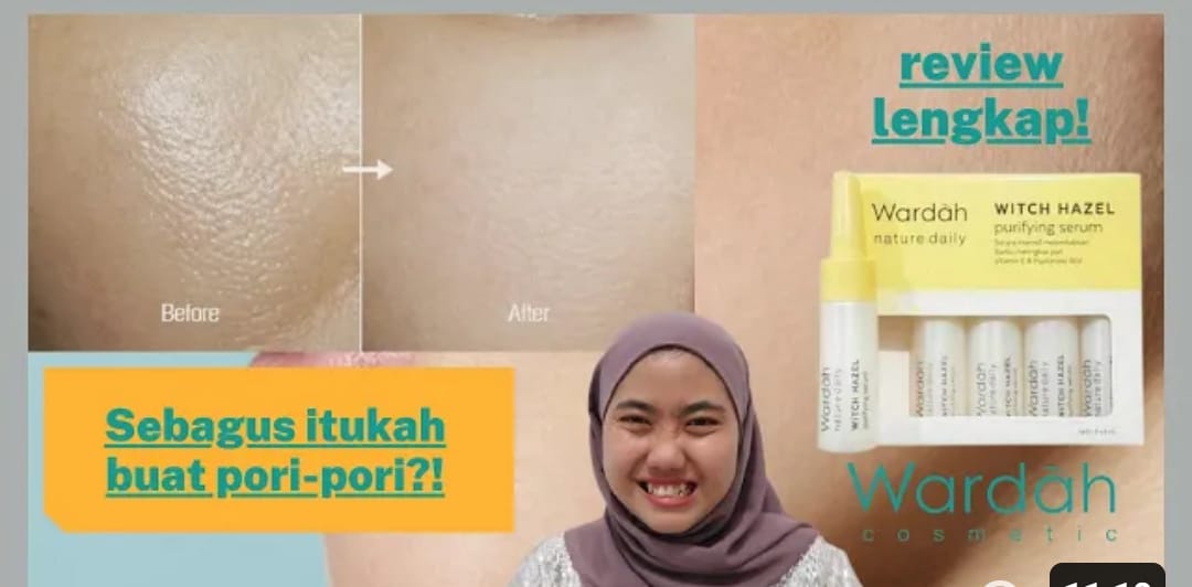 5 Skincare Wardah untuk Mengecilkan Pori-Pori Wajah Terbaik 2023! Wajah Bebas Flek Hitam, Ada di Indomaret