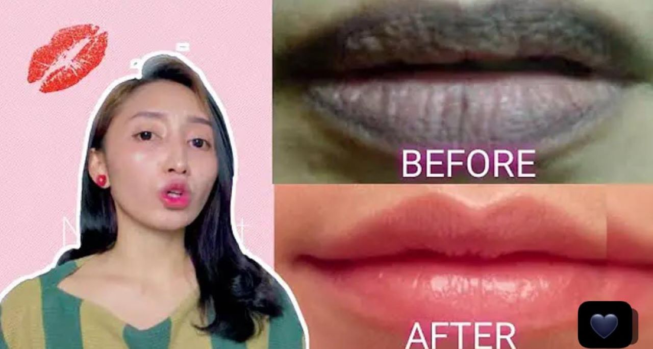 4 Cara Mencerahkan Bibir Hitam Secara Alami, Hasil Bibir Merah Merona Permanen