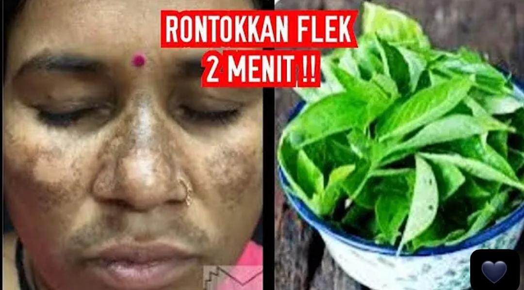 4 Daun Penghilang Flek Hitam di Wajah ini Ampuh Hempaskan Noda Hingga Kerutan, Wajah jadi Awet Muda!