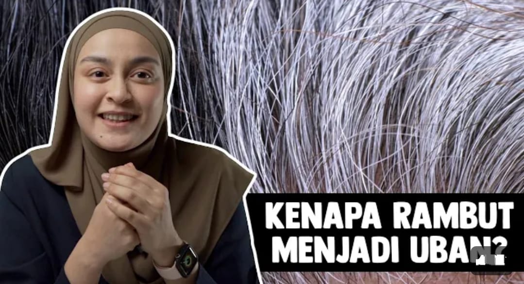 Bagaimana Cara Mencegah Uban Supaya Ga Tumbuh Lagi? Ikuti 4 Tips Agar Rambut Hitam Permanen Hingga ke Akar