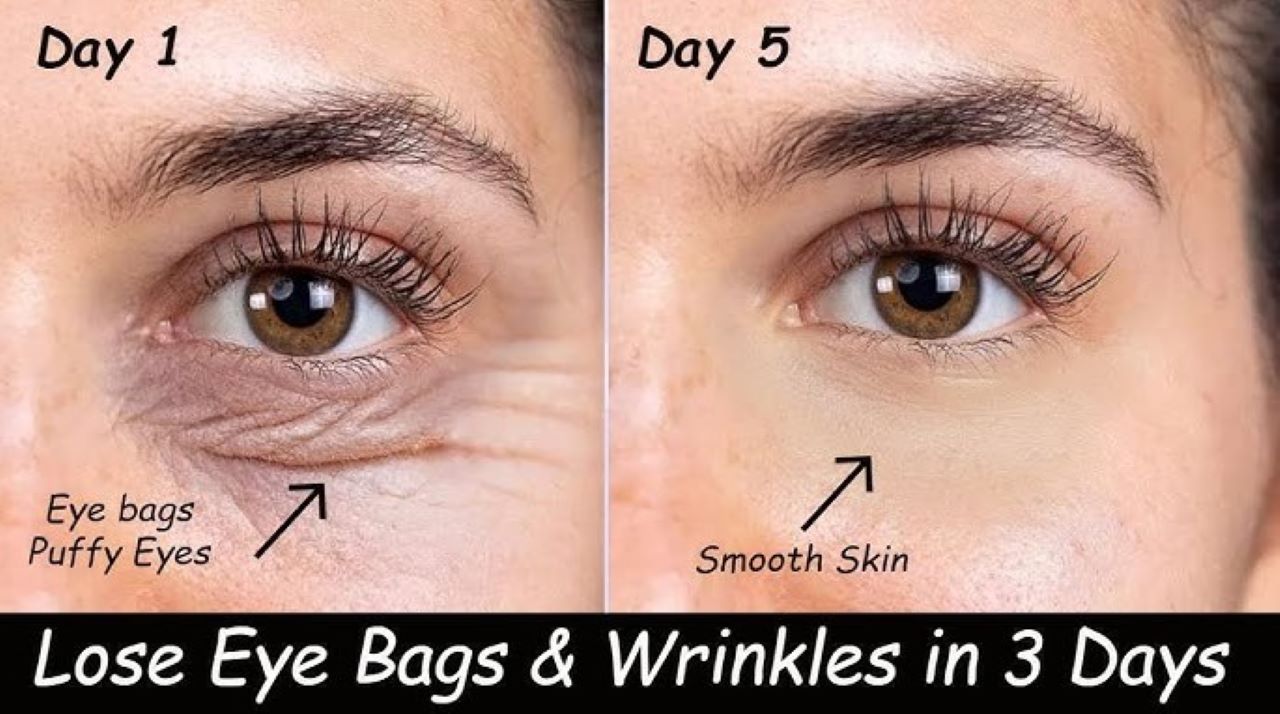 Cara Bikin Eye Mask Agar Kulit Tetap Kencang, Saatnya Katakan Bye Tanda Penuaan! 