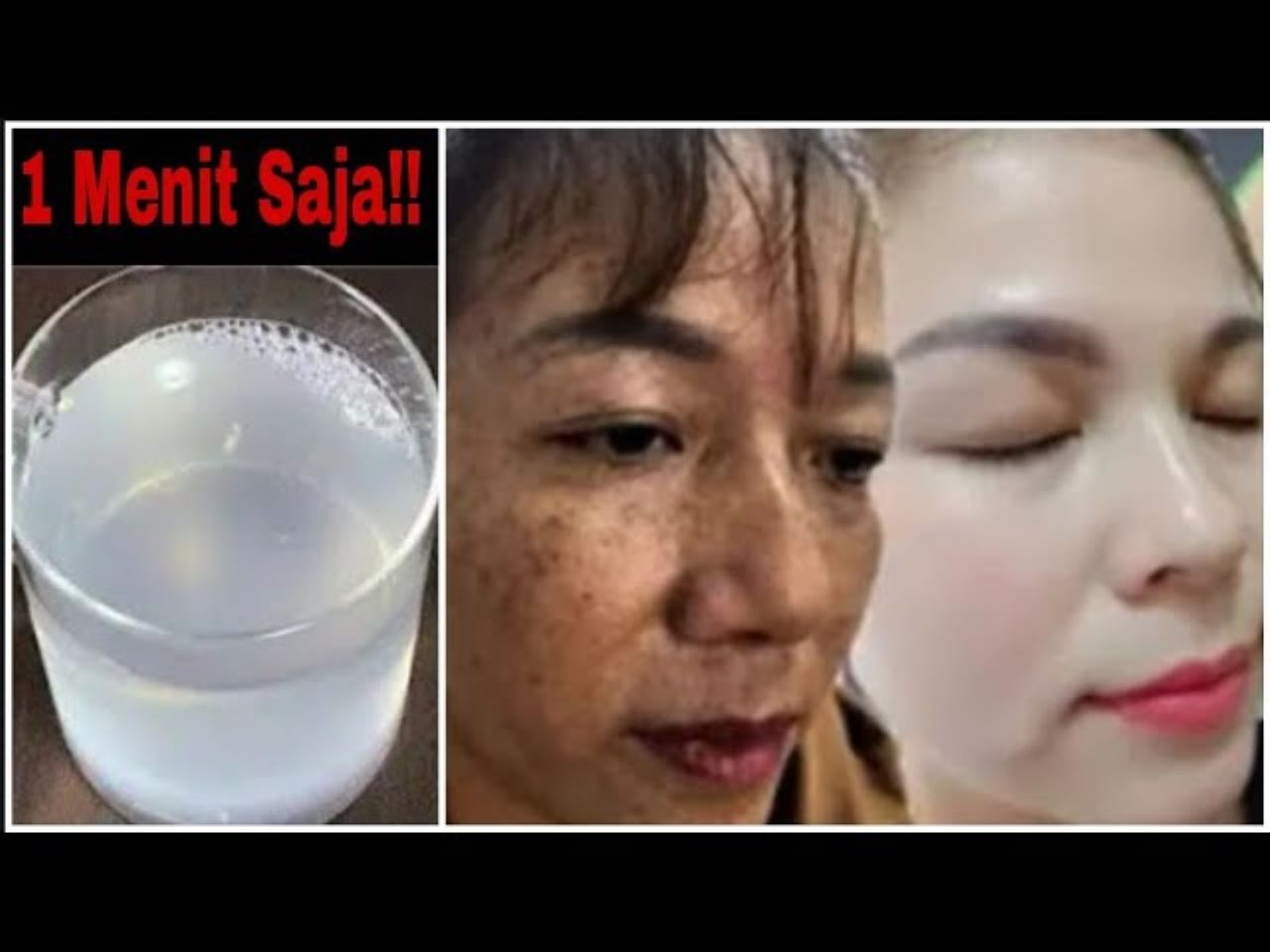 Cara Menghilangkan Flek Hitam Dengan Air Mawar yang Bikin Wajah Mulus, Cocok Untuk Cuaca Panas Pekalongan!