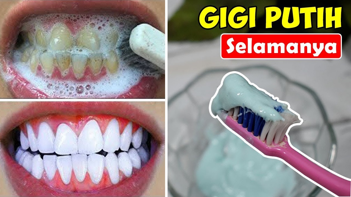 4 Cara Menghilangkan Karang Gigi dengan Baking Soda, Efektif Putihkan Gigi Hingga Bersih Anti Plak dan Karang