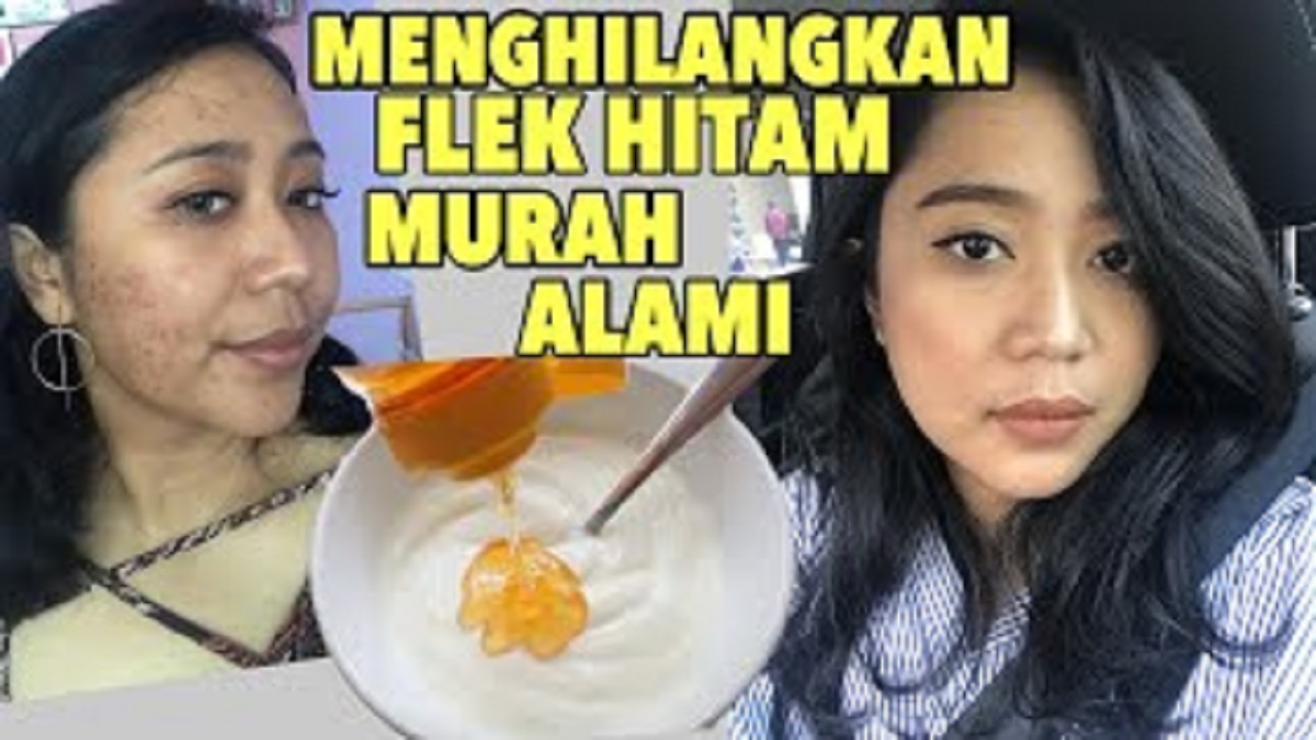 Cara Pakai Bahan Dapur untuk Menghilangkan Flek Hitam, 4 Tips Terbaik Wajah Putih Alami