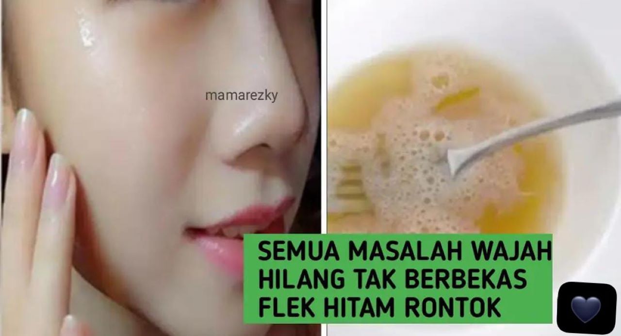 4 Tips Menghilangkan Flek Hitam Menahun di Wajah Secara Alami Dengan Cepat