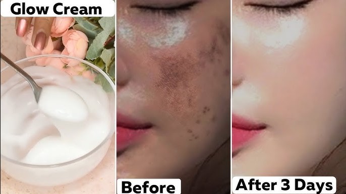 Racikan DIY Krim Malam untuk Wajah Glowing dalam 1 Malam, Alternatif Pudarkan Flek Hitam dengan Cepat