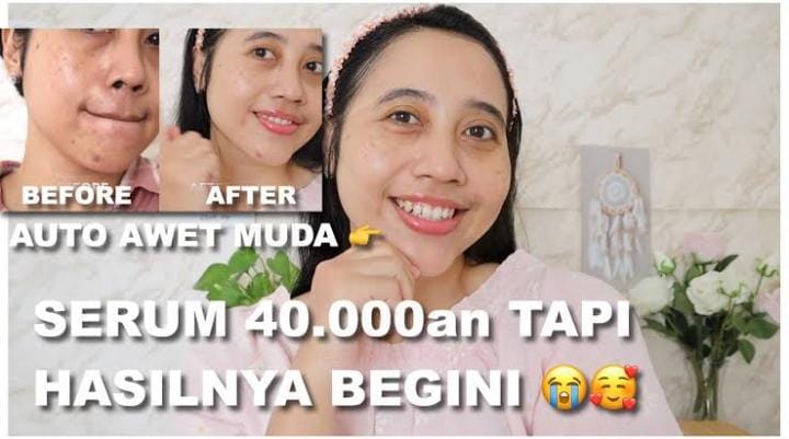 Serum Terbaik untuk Mengencangkan Kulit Usia 40 Tahun ke Atas, Bikin Awet Muda Bebas Kerutan dan Noda