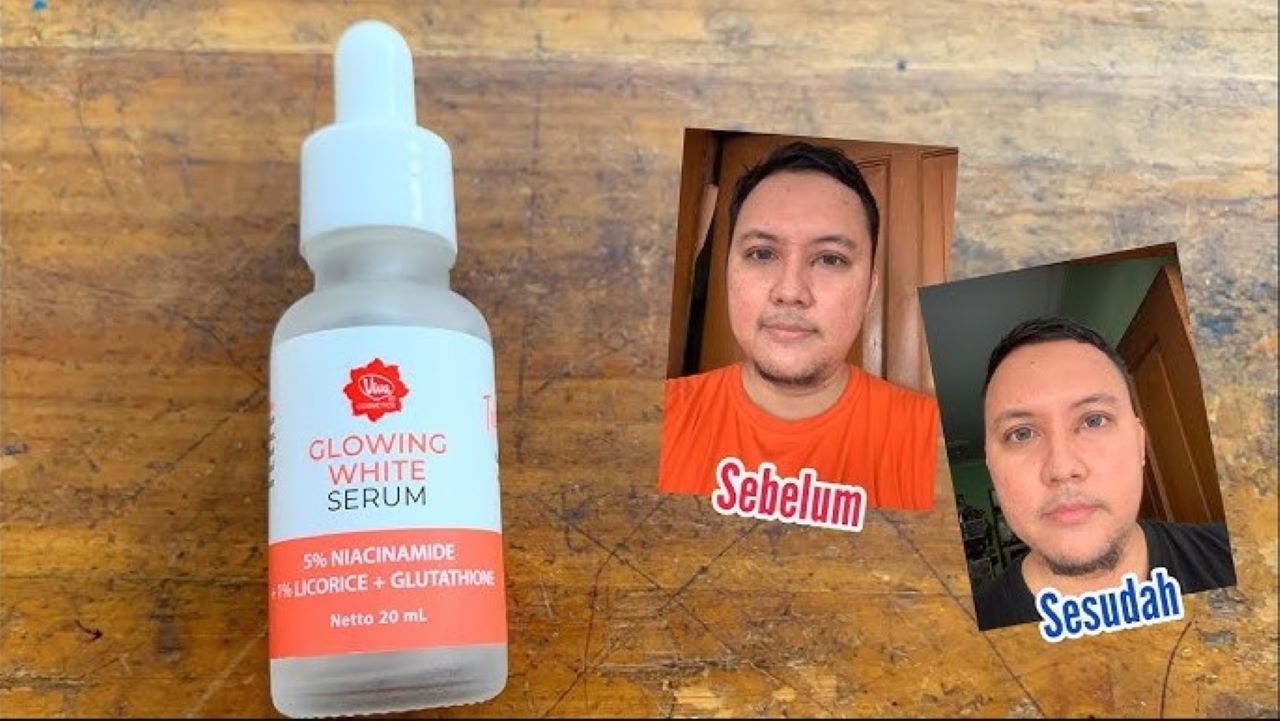 4 Merk Serum Viva yang Bisa Dipakai Remaja, Formula Aman Nggak Bikin Kulit Iritasi