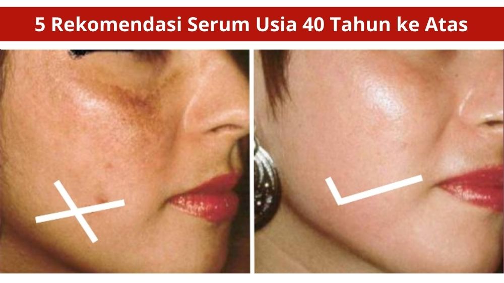 5 Rekomendasi Serum Usia 40 Tahun ke Atas, Pudarkan Flek dan Garis Halus Rahasia Tanpa Tanda Penuaan