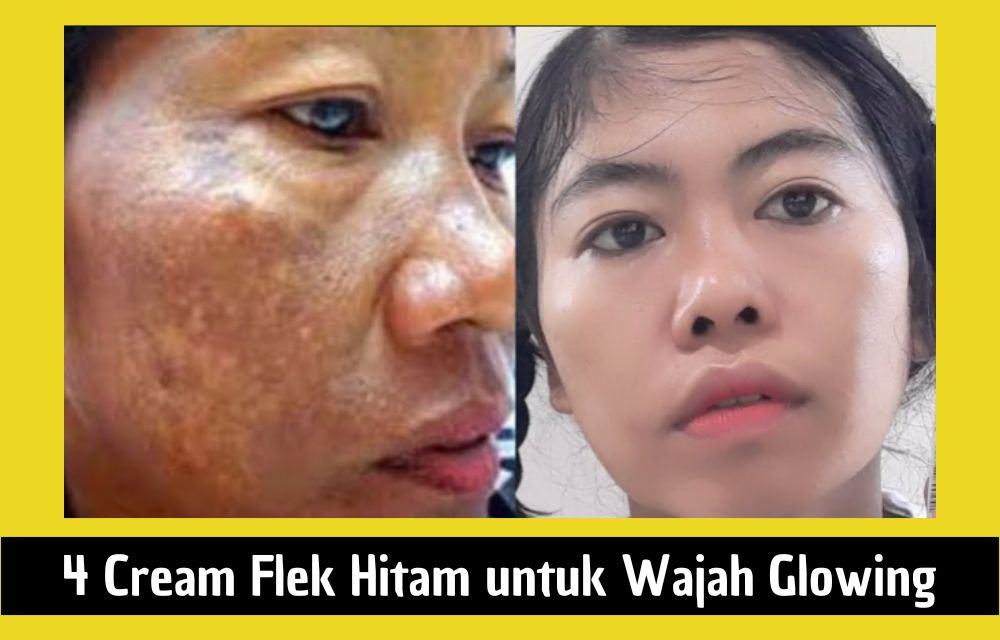 4 Rekomendasi Cream Flek Hitam untuk Wajah Glowing, Cocok Dipakai Usia 40 Tahun ke Atas Agar Awet Muda