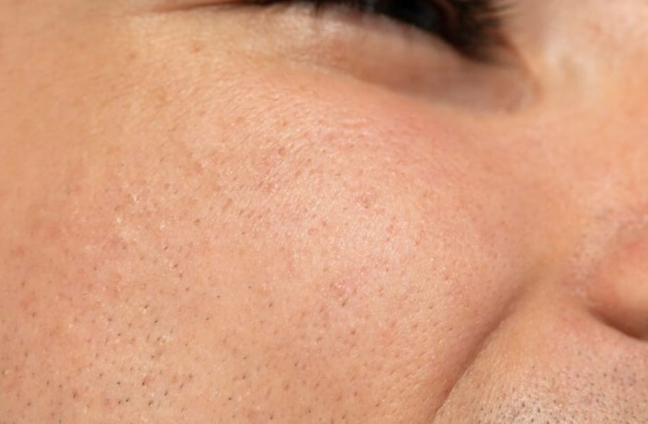 Cara Membuat Pengecil Pori-Pori Buatan Sendiri dari Bahan Dapur, Wajah jadi Mulus dan Glowing