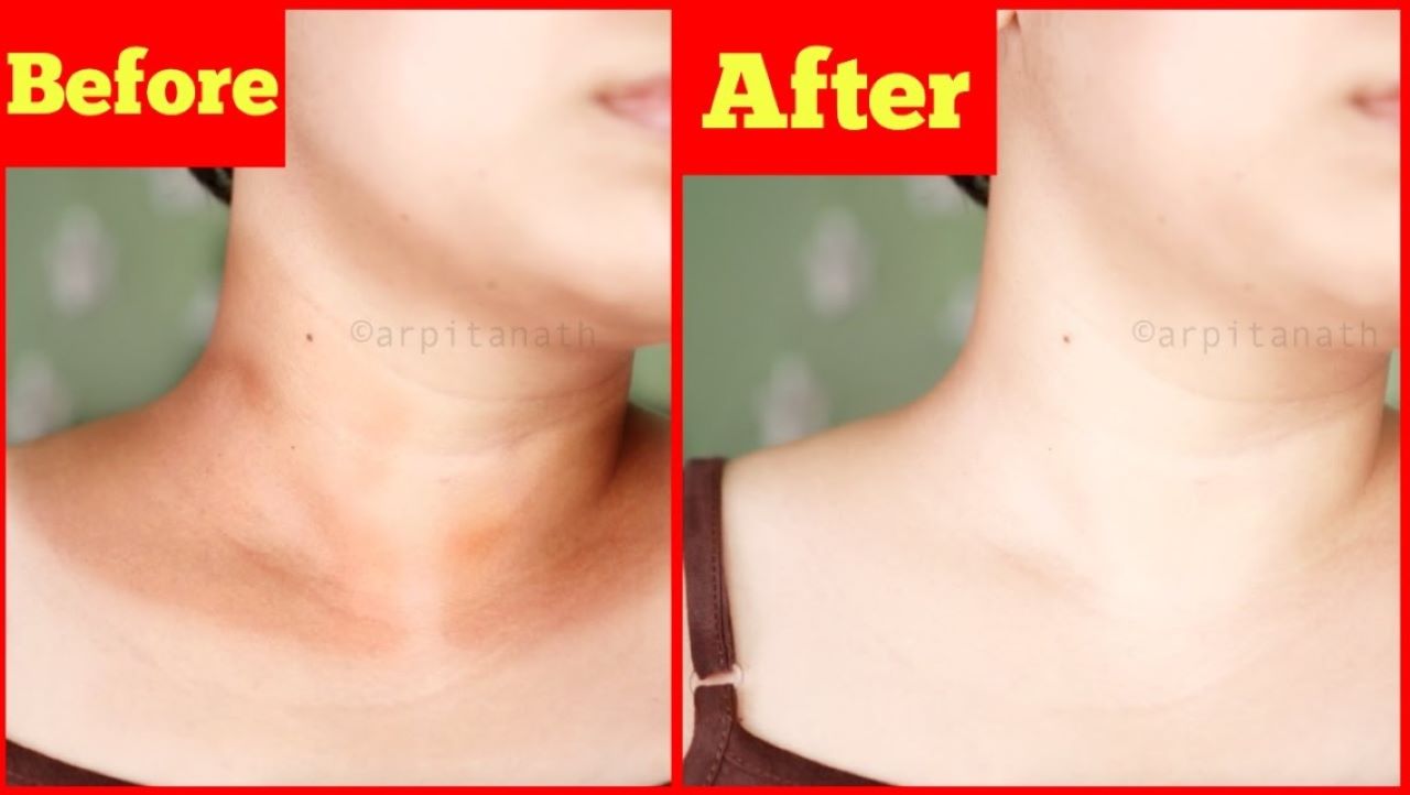 Cara Mencerahkan Leher dengan Bubuk Kopi, Campurkan Pakai 3 Jenis Bahan Ini