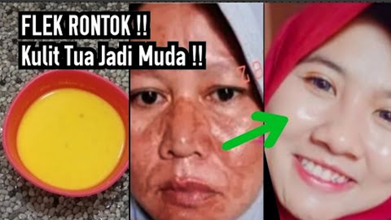 3 Bahan Alami untuk Mencerahkan Wajah Kusam dan Flek Hitam, Bisa Dibuat Di Rumah Lho!