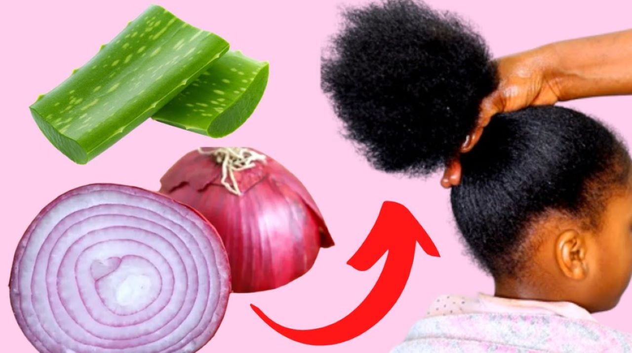 Begini Cara Pakai Bawang untuk Menumbuhkan Rambut Tipis Agar Menjadi Tebal, Campur 2 Bahan Ini