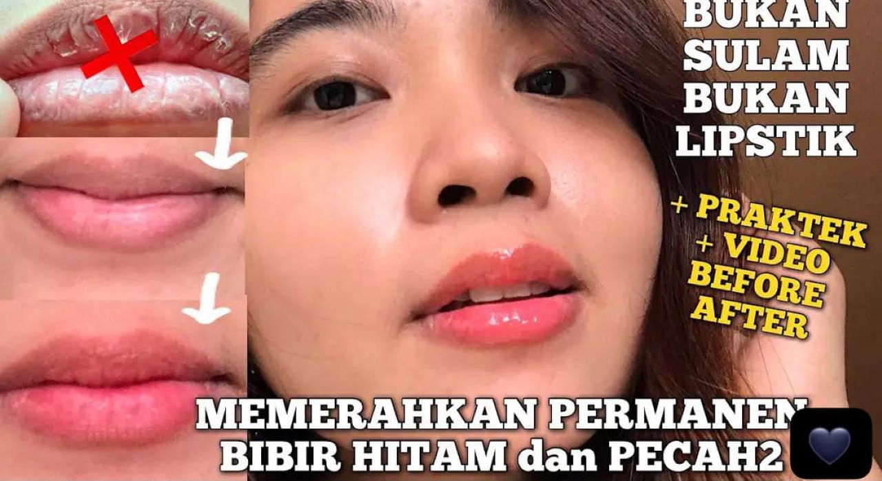 3 Tips Membuat Masker Bibir Alami untuk Mencerahkan Bibir Hitam Cuma Pakai Bahan Dapur