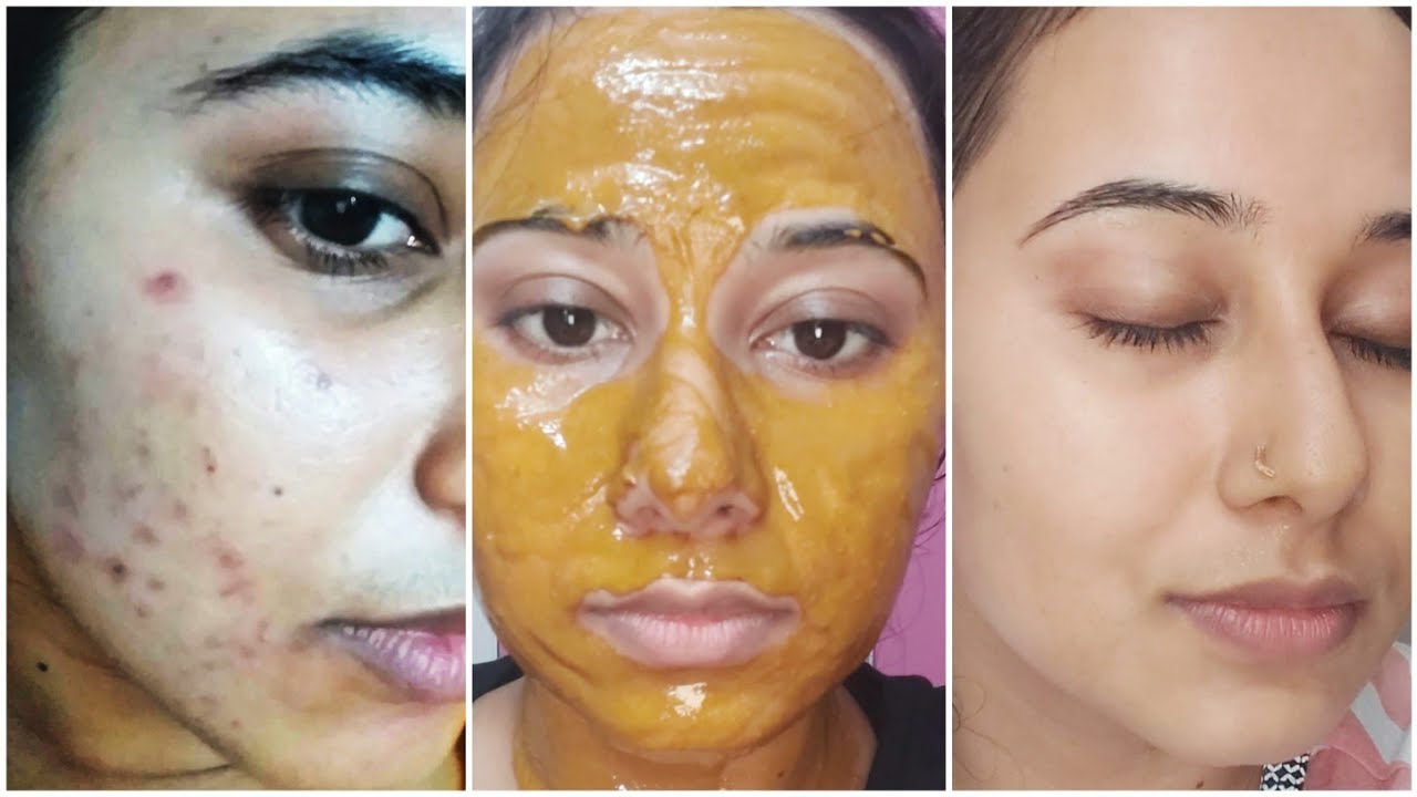 4 Masker Kolagen Alami Untuk Menghilangkan Flek Hitam Menahun Wajah Glowing Awet Muda Bebas 