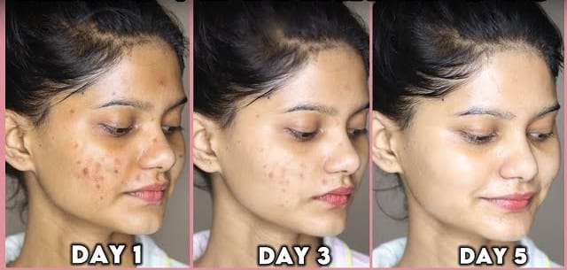 4 Sunscreen untuk Flek Hitam dan Kulit Kering, Rutin Pakai Bikin Mulus Awet Muda di Usia 40 Tahun ke Atas