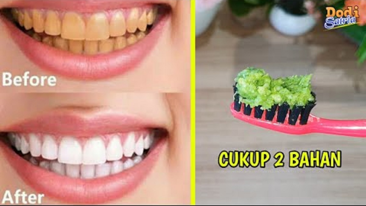 Begini Cara Cepat Memutihkan Gigi secara Alami dalam Waktu 1 Hari, Bersihkan Gigi Hingga Putih Tidak Ada Plak