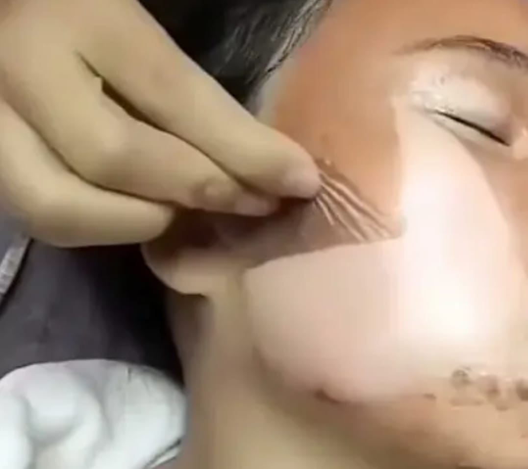 3 Cara Instan Agar Flek Hitam di Wajah Cepat Mengelupas Hingga Mulus, Bantu Memutihkan Kulit dan Kecilkan Pori