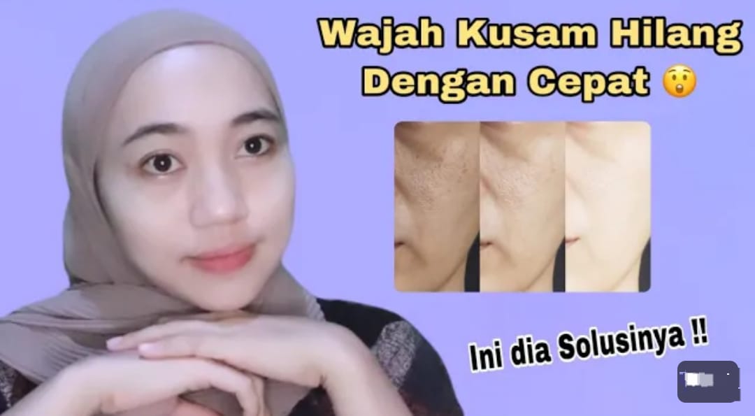 4 Cara Ampuh Memutihkan Wajah Pakai Bahan Dapur, Kulit Bebas Noda Hitam dan Kencang Meski Sudah Lanjut Usia