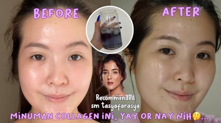 Ternyata, Ini 4 Minuman Collagen Agar Awet Muda, Kulit Kencang Glowing Bebas Keriput dan Jerawat