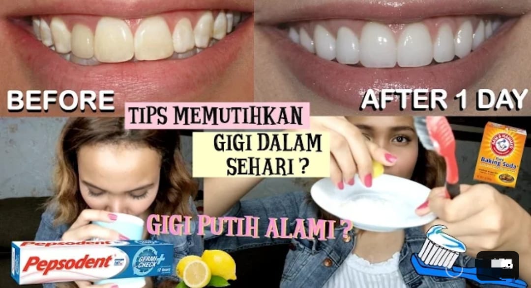 3 Cara Menghilangkan Gigi Kuning Secara Alami Dengan Cepat, Memutihkan dan Bersihkan Karang Gigi Dalam 1 Hari