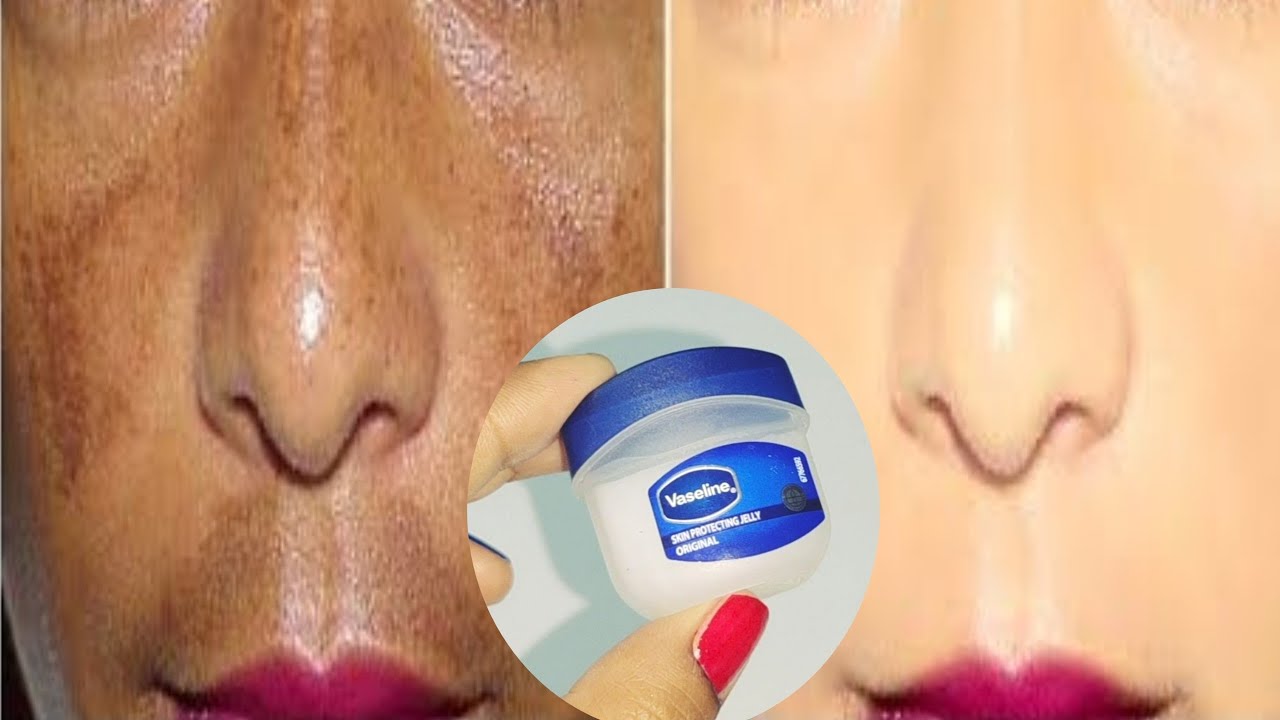 Begini Cara Menggunakan Vaseline Repairing Jelly untuk Flek Hitam, Cocok untuk Ibu-Ibu Usia 40 Tahun