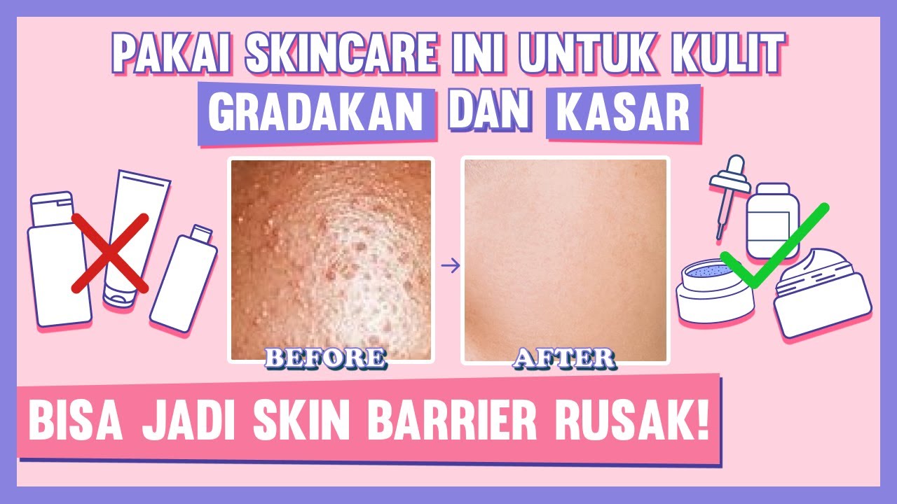 4 Skincare untuk Menyehatkan Skin Barrier Agar Kulit Sehat dan Glowing