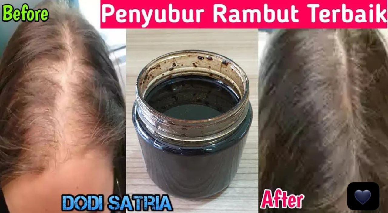 4 Minyak Alami Penghitam Rambut Uban Permanen, Bantu Hitamkan Rambut Hingga Akar