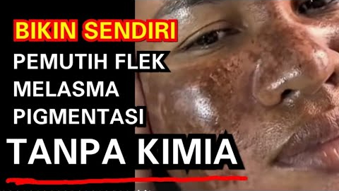 Resep Masker Alami Penghilang Flek Hitam dengan Bahan Dapur, Bikin Wajah Cerah dalam Semalam Tanpa Skincare