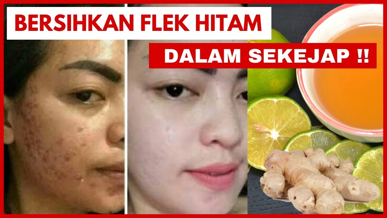 Resep Minuman Kolagen untuk Bersihkan Flek Hitam, Rahasia Bikin Wajah Putih Mulus Bebas Keriput 