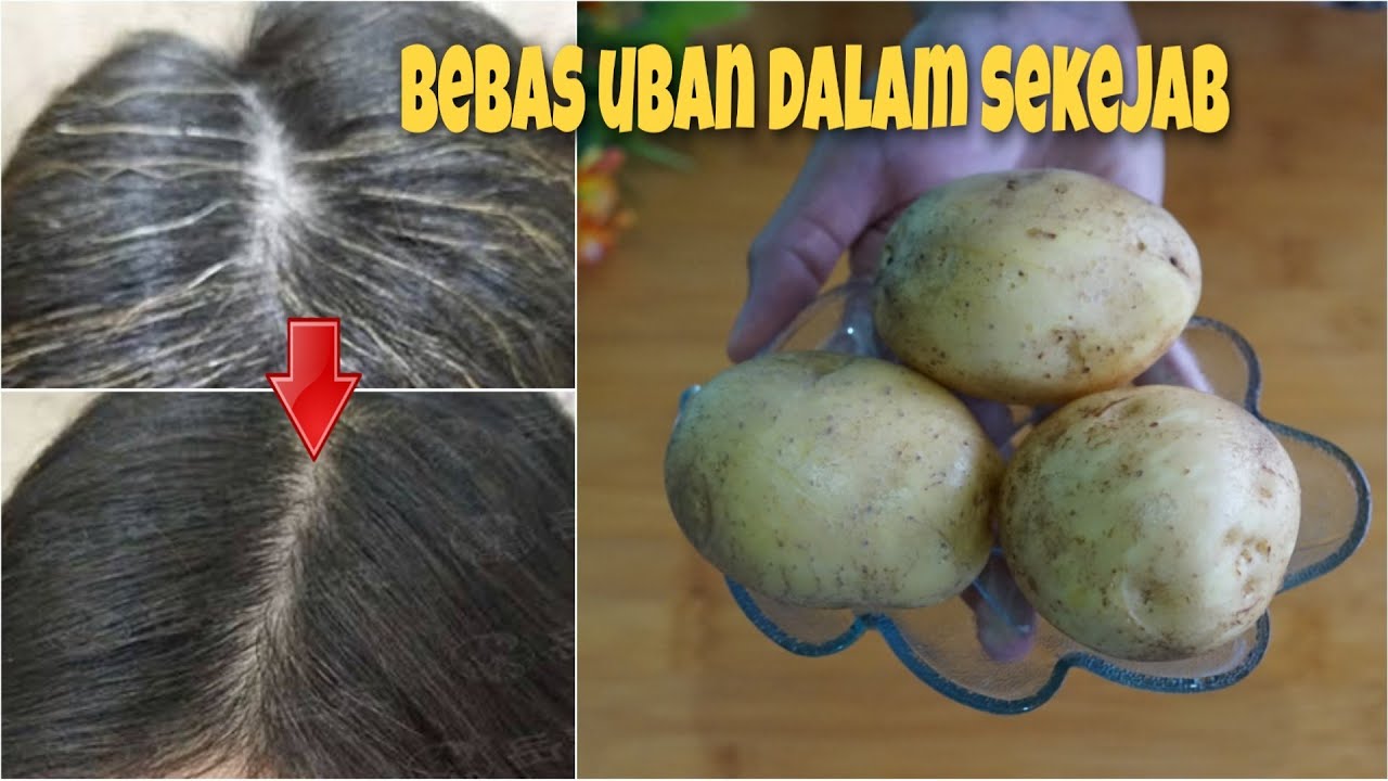 3 Cara Menghilangkan Uban Sampai Akarnya Tanpa Dicabut, Cukup 1 Bahan Rambut Hitam Permanen Sekali Usap