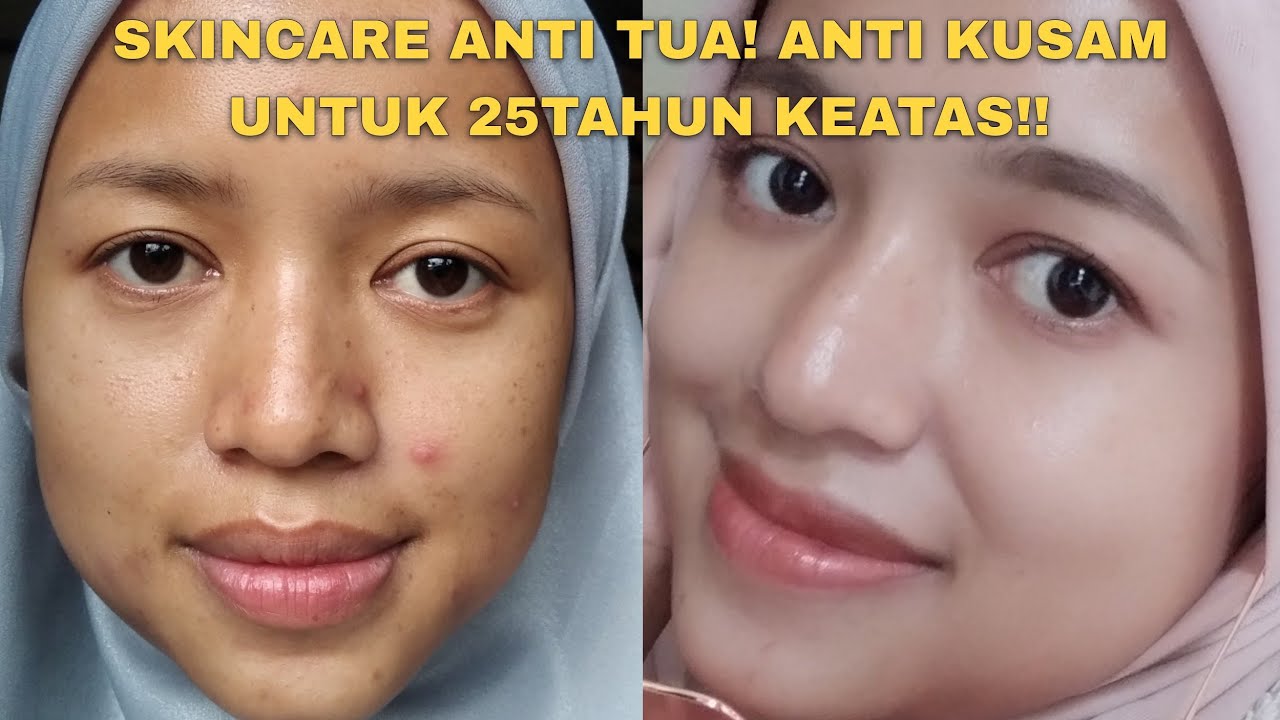 4 Skincare Lokal Tanpa Merkuri yang Murah di Shopee, Bikin Kulit Putih Awet Muda di Bawah 50 Ribuan