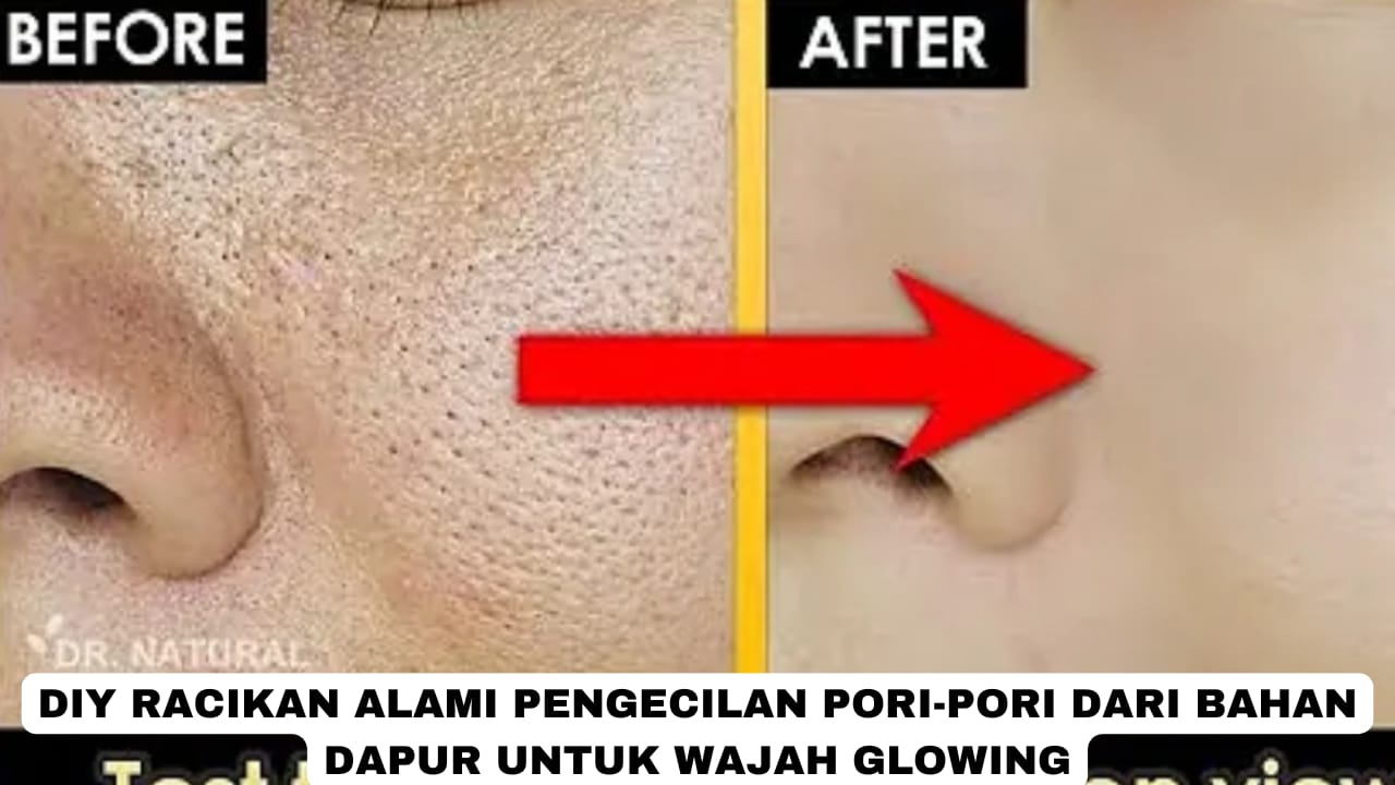 DIY Racikan Alami Pengecil Pori-Pori Dari Bahan Dapur, Kulit Langsung Glowing Bebas Noda Hitam Cuma Pakai Ini 