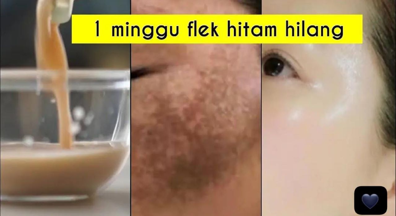 4 Tips Wajah Glowing Alami Agar Flek Hitam Hilang dan Kulit Jadi Kencang Awet Muda