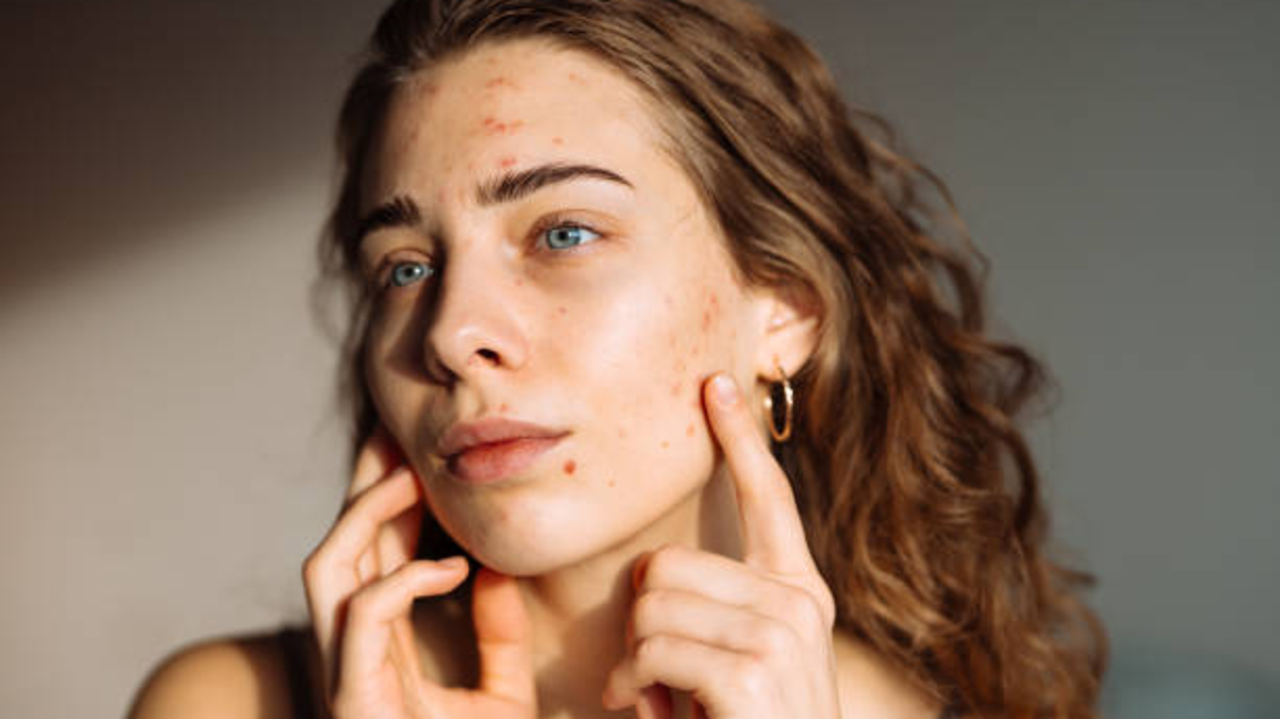 Mulai 30 Ribuan! Rekomendasi Sunscreen untuk Flek Hitam Usia 40 Tahun Ke Atas Ini Wajib Dicoba