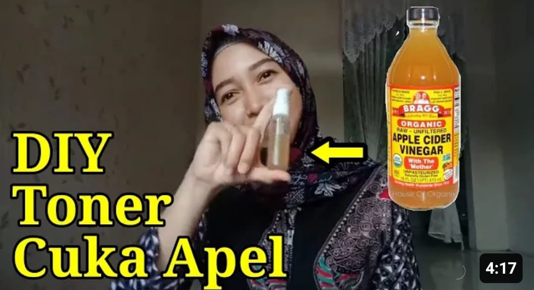 4 Petunjuk Menghilangkan Flek Hitam dan Memutihkan Wajah! Ini Cara Pakai Cuka Apel untuk Wajah yang Benar