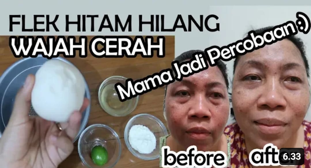 Pengalamanku menghilangkan Flek Hitam dengan Jeruk Nipis! Wajah Putih Glowing Serta Bebas Kerutan