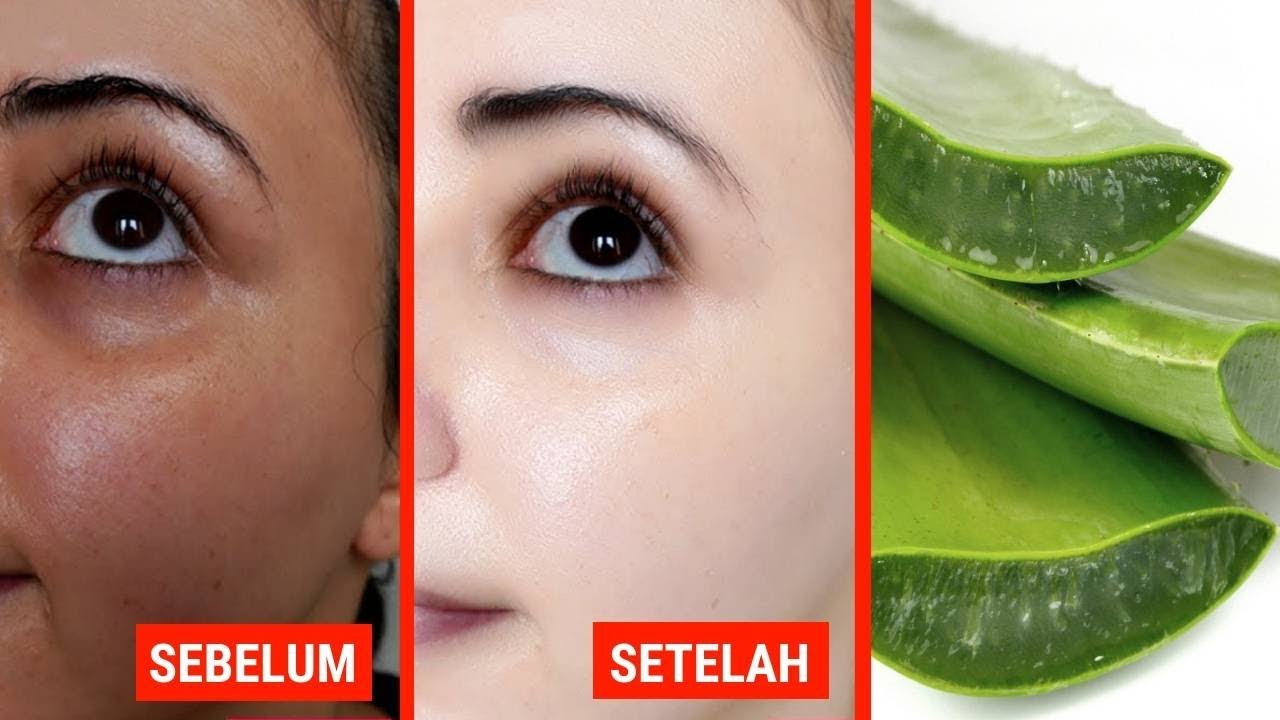 Cara Memutihkan Wajah dengan Lidah Buaya dalam 1 Hari Secara Alami, Bikin Mulus dan Glowing Bebas Noda