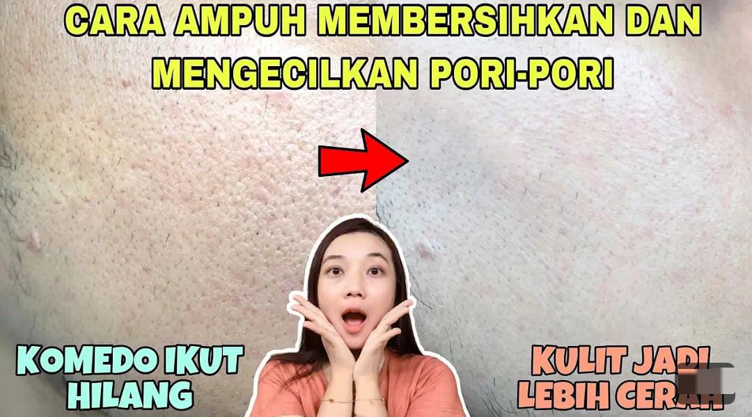 3 Cara Membuat Masker untuk Mengecilkan Pori-Pori Wajah Dengan Bahan Dapur, Kulit jadi Mulus Bebas Flek Hitam